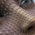 face details of buds on skin in 3D